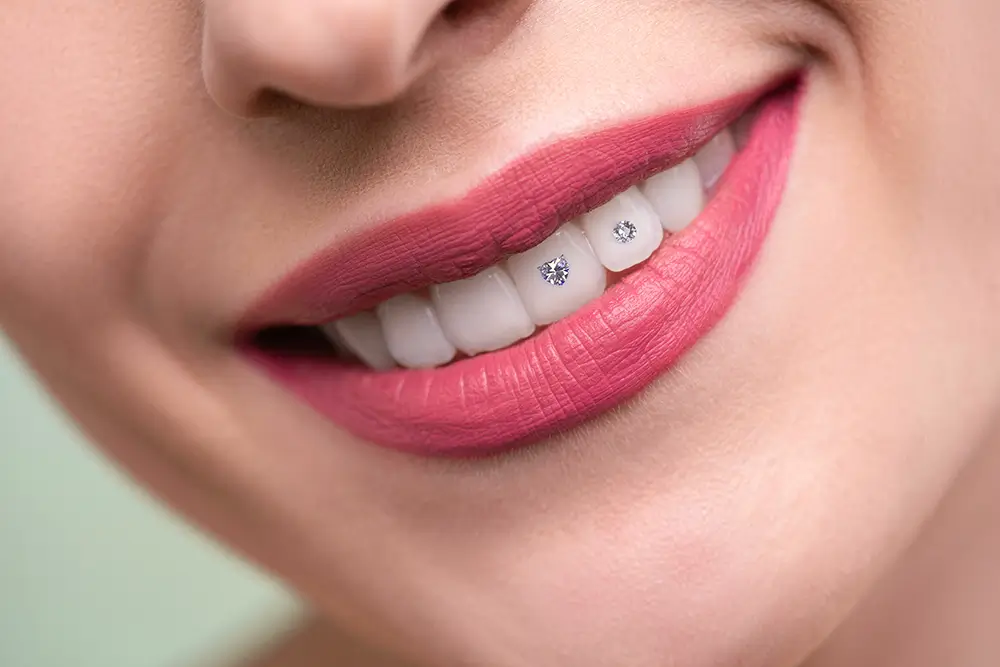 What You Need To Know About Teeth Jewelry
