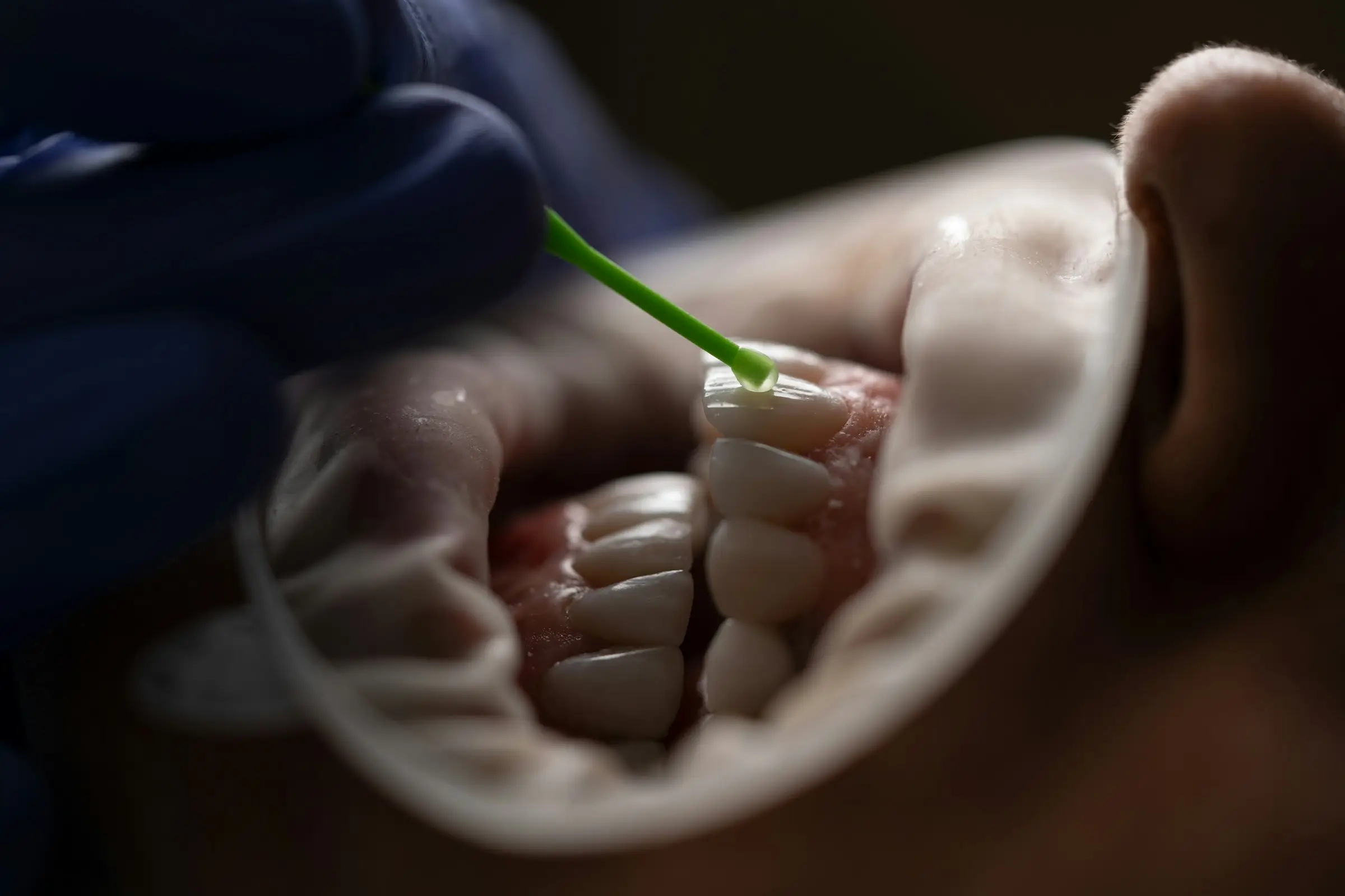 Jewelry for your teeth on sale